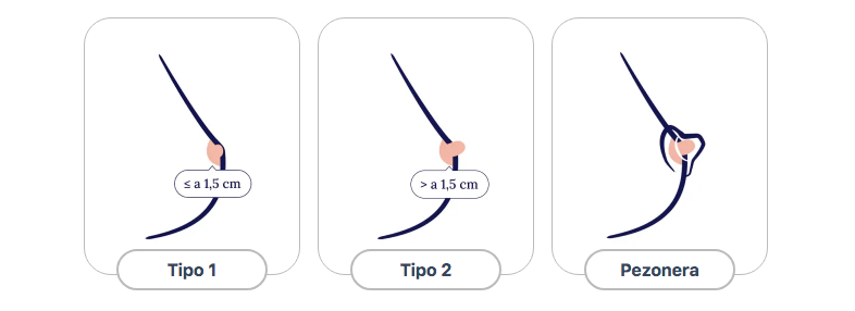 Personalización del biberón lactancia materna